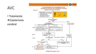AVC
• Tratamento
Cateterismo
cerebral
 