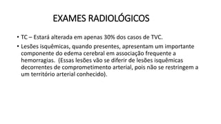 EXAMES RADIOLÓGICOS
• TC – Estará alterada em apenas 30% dos casos de TVC.
• Lesões isquêmicas, quando presentes, apresentam um importante
componente do edema cerebral em associação frequente a
hemorragias. (Essas lesões vão se diferir de lesões isquêmicas
decorrentes de comprometimento arterial, pois não se restringem a
um território arterial conhecido).
 