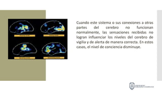 Cuando este sistema o sus conexiones a otras
partes del cerebro no funcionan
normalmente, las sensaciones recibidas no
logran influenciar los niveles del cerebro de
vigilia y de alerta de manera correcta. En estos
casos, el nivel de conciencia disminuye.
 