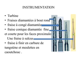 INSTRUMENTATION
• Turbine
• Fraises diamantées à bout rond
• fraise à congé diamantée
• fraise conique diamantée fine
et courte pour les faces proximales
Une fraise à sulcus
• fraise à finir en carbure de
tungstène et meulettes en
caoutchouc .
 
