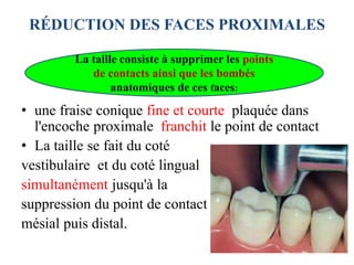 RÉDUCTION DES FACES PROXIMALES
• une fraise conique fine et courte plaquée dans
l'encoche proximale franchit le point de contact
• La taille se fait du coté
vestibulaire et du coté lingual
simultanément jusqu'à la
suppression du point de contact
mésial puis distal.
La taille consiste à supprimer les points
de contacts ainsi que les bombés
anatomiques de ces faces:
 