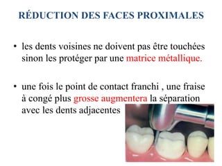 RÉDUCTION DES FACES PROXIMALES
• les dents voisines ne doivent pas être touchées
sinon les protéger par une matrice métallique.
• une fois le point de contact franchi , une fraise
à congé plus grosse augmentera la séparation
avec les dents adjacentes
 