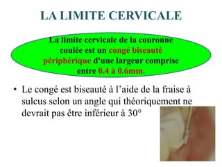 LA LIMITE CERVICALE
• Le congé est biseauté à l’aide de la fraise à
sulcus selon un angle qui théoriquement ne
devrait pas être inférieur à 30°
La limite cervicale de la couronne
coulée est un congé biseauté
périphérique d'une largeur comprise
entre 0.4 à 0.6mm.
 