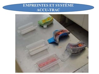 EMPREINTES ET SYSTÈME
ACCU-TRAC
 