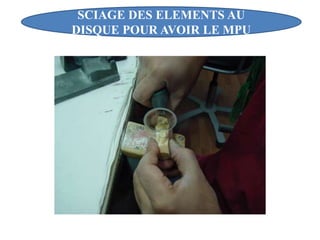 SCIAGE DES ELEMENTS AU
DISQUE POUR AVOIR LE MPU
 
