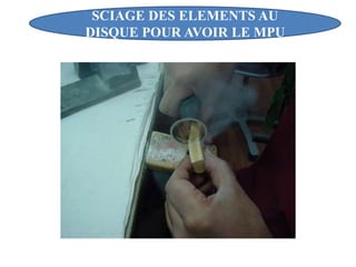 SCIAGE DES ELEMENTS AU
DISQUE POUR AVOIR LE MPU
 