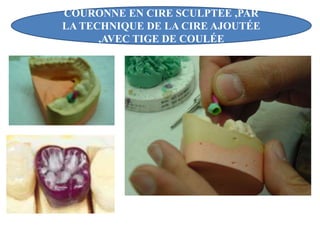 COURONNE EN CIRE SCULPTEE ,PAR
LA TECHNIQUE DE LA CIRE AJOUTÉE
,AVEC TIGE DE COULÉE
 