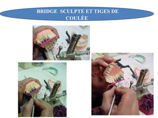 BRIDGE SCULPTE ET TIGES DE
COULÉE
 