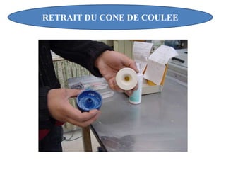 RETRAIT DU CONE DE COULEE
 