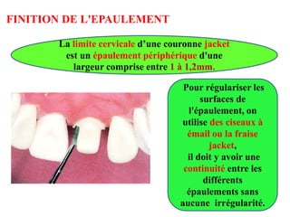 FINITION DE L'EPAULEMENT
Pour régulariser les
surfaces de
l'épaulement, on
utilise des ciseaux à
émail ou la fraise
jacket,
il doit y avoir une
continuité entre les
différents
épaulements sans
aucune irrégularité.
La limite cervicale d’une couronne jacket
est un épaulement périphérique d'une
largeur comprise entre 1 à 1,2mm.
 