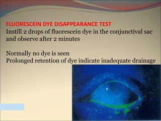 FLUORESCEIN DYE DISAPPEARANCE TEST
Instill 2 drops of fluorescein dye in the conjunctival sac
and observe after 2 minutes
Normally no dye is seen
Prolonged retention of dye indicate inadequate drainage
 