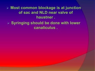  Most common blockage is at junction 
of sac and NLD near valve of 
haustner . 
 Syringing should be done with lower 
canaliculus . 
 