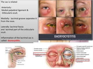 The sac is related
Anteriorly :
Medial palpebral ligament &
Orbicularis oculi.
Medially: lacrimal groove separates it
from the nose.
Laterally: lacrimal fascia
and lacrimal part of the orbicularis
oculi.
Inflammation of the lacrimal sac is
called- dacrocystitis.
 