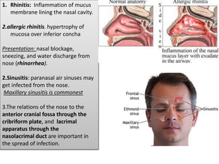 1. Rhinitis: Inflammation of mucus
membrane lining the nasal cavity.
2.allergic rhinitis. hypertrophy of
mucosa over inferior concha
Presentation: nasal blockage,
sneezing, and water discharge from
nose (rhinorrhea).
2.Sinusitis: paranasal air sinuses may
get infected from the nose.
Maxillary sinusitis is commonest
3.The relations of the nose to the
anterior cranial fossa through the
cribriform plate, and lacrimal
apparatus through the
nasolacrimal duct are important in
the spread of infection.
 