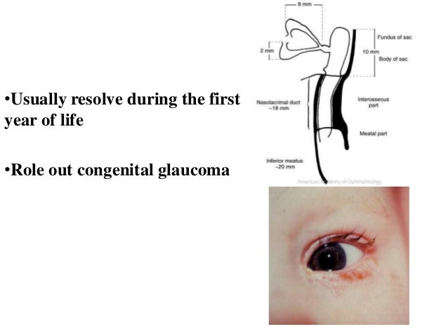 3 Best Nutrients For Dry Eyes