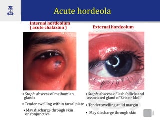 Lacrimal eyelids and conjunctivites_0.pdf