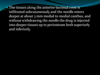  The tissues along the anterior lacrimal crest is
infiltrated subcutaneously and the needle enters
deeper at about 3 mm medial to medial canthus, and
without withdrawing the needle the drug is injected
into deeper tissues up to periosteum both superiorly
and inferiorly.
 