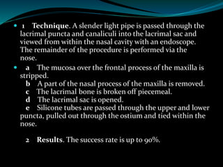  1 Technique. A slender light pipe is passed through the
lacrimal puncta and canaliculi into the lacrimal sac and
viewed from within the nasal cavity with an endoscope.
The remainder of the procedure is performed via the
nose.
 a The mucosa over the frontal process of the maxilla is
stripped.
b A part of the nasal process of the maxilla is removed.
c The lacrimal bone is broken off piecemeal.
d The lacrimal sac is opened.
e Silicone tubes are passed through the upper and lower
puncta, pulled out through the ostium and tied within the
nose.
2 Results. The success rate is up to 90%.
 