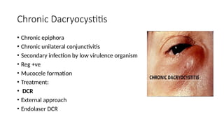 Chronic Dacryocystitis
• Chronic epiphora
• Chronic unilateral conjunctivitis
• Secondary infection by low virulence organism
• Reg +ve
• Mucocele formation
• Treatment:
• DCR
• External approach
• Endolaser DCR
 