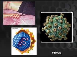 VIRUS
 