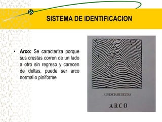 SISTEMA DE IDENTIFICACION
• Arco: Se caracteriza porque
sus crestas corren de un lado
a otro sin regreso y carecen
de deltas, puede ser arco
normal o piniforme
 