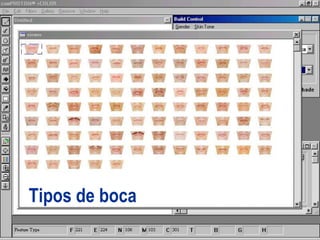 Tipos de boca
 