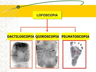 QUIROSCOPIA PELMATOSCOPIA
DACTILOSCOPIA
LOFOSCOPIA
 