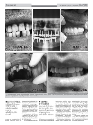 Empresa

35
La Crónica
Del sábado 26 de octubre al viernes 1 de noviembre de 2013

ANTES

DESPUÉS

DESPUÉS

ANTES

La clínica Dicudent, situada en Villanueva de Algaidas, es especialista en estética dental. Como puede observarse en las imágenes el cambio estético que obtiene
el cliente es gratificante, lo que le proporciona calidad de vida.

ESTE CENTRO,
utiliza el sistema
CAD-CAM, el
más innovador
para la
rehabilitación
dental
ces que van emergiendo en el
sector. Todo ello unido al

prestigioso equipamiento que
la compone, destacando aparatos como la ortopantografía, teleradiografía, cámara
intraoral, lámpara de blanqueamiento de última generación... que hacen que esta
clínica realice el mejor diagnóstico y exactitud de tratamiento.
La excelencia de Clínica
Dicudent se basa en el
exhaustivo seguimiento y personalización en el tratamiento
de cada paciente.
Dicudent destaca que una

CLÍNICA
DICUDENT,
emplea el sistema
de implantes más
avanzado para que
el paciente no
note dolor alguno
de las mayores cualidades de
la clínica es la de disponer de

laboratorio propio, realizando, de este modo, todos
los trabajos dentales, y
pasando por exhaustivos controles de calidad y mayor
rapidez en el supuesto de que
se produzca alguna rotura o
problemas con la prótesis.
Dicudent utiliza el sistema
de implantes mas avanzado
para que el paciente no note
dolor alguno y se llegue a
los mejores resultados tanto
estéticos como funcionales.
La asiduidad de pacientes
de esta clínica no reside solo

en Villanueva de Algaidas,
sino también de los pueblos
colindantes como Alameda,
Cuevas de San Marcos, Cuevas Bajas, Sierra de Yeguas,
Archidona, Mollina o Antequera, entre otras localidades,
de ahí destaca el importante
hueco que se ha hecho en la
comarca de Antequera esta
clínica.
Por último, reseñar que
dicha clinica también cuenta
dentro de sus instalaciones
con un gabinete podologico
de última generación.

 