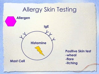 Allergy Skin Testing
   Allergen

                     IgE



                    Y
      Y


                      Y
    Y




                           Y
              Histamine

                               Positive Skin test
                               -wheal
                               -flare
Mast Cell
                               -itching
 