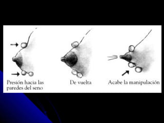 Lactancia