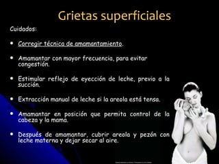Grietas superficiales
Cuidados:

   Corregir técnica de amamantamiento.

   Amamantar con mayor frecuencia, para evitar
    congestión.

   Estimular reflejo de eyección de leche, previo a la
    succión.

   Extracción manual de leche si la areola está tensa.

   Amamantar en posición que permita control de la
    cabeza y la mama.

   Después de amamantar, cubrir areola y pezón con
    leche materna y dejar secar al aire.
 
