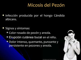 Micosis del Pezón
   Infección producida por el hongo Cándida
    albicans.

   Signos y síntomas:
      Color rosado de pezón y areola.
      Erupción cutánea bucal en el niño.
      Dolor intenso, quemante, punzante y
       persistente en pezones y areola.
 
