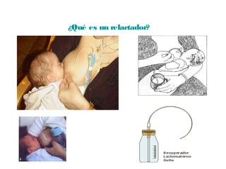¿Qué es un relactador?
 