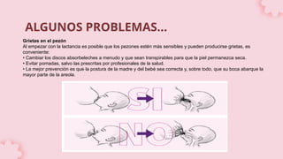 ALGUNOS PROBLEMAS…
Grietas en el pezón
Al empezar con la lactancia es posible que los pezones estén más sensibles y pueden producirse grietas, es
conveniente:
• Cambiar los discos absorbeleches a menudo y que sean transpirables para que la piel permanezca seca.
• Evitar pomadas, salvo las prescritas por profesionales de la salud.
• La mejor prevención es que la postura de la madre y del bebé sea correcta y, sobre todo, que su boca abarque la
mayor parte de la areola.
 