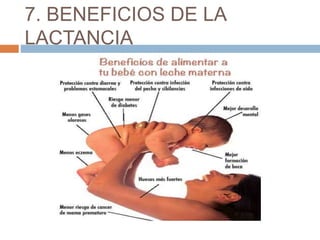 7. BENEFICIOS DE LA
LACTANCIA
 