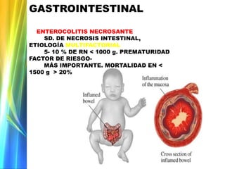 GASTROINTESTINAL
ENTEROCOLITIS NECROSANTE
SD. DE NECROSIS INTESTINAL,
ETIOLOGÍA MULTIFACTORIAL
5- 10 % DE RN < 1000 g. PREMATURIDAD
FACTOR DE RIESGO-
MÁS IMPORTANTE. MORTALIDAD EN <
1500 g > 20%
 