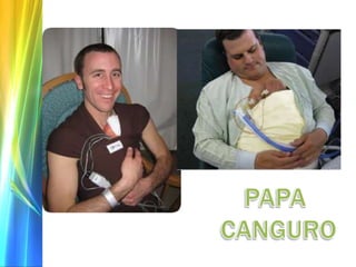 Lactancia materna en el prematuro