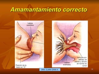 Amamantamiento correcto  E.U. Silvia Lagos A. DRA. CLARA GANA A. 