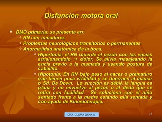 Disfunción motora oral DMO primaria:  se presenta en:  RN con inmadurez  Problemas neurológicos transitorios o permanentes Anormalidad anatómica de la boca. Hipertonía: el RN muerde el pezón con las encías atrisionandolo    dolor. Se alivia masajeando la encia previo a la mamada y usando postura de caballito. Hipotonía: En RN bajo peso al nacer o prematuro que tienen poca vitalidad y se duermen al mamar o Sd. De Down.  La succión es débil, la lengua es plana y no envuelve al pezón o al dedo que se retira con facilidad.  Se soluciona con el niño sentado frente a la madre estando ella sentada y con ayuda de Kinesioterapia. E.U. Silvia Lagos A. DRA. CLARA GANA A. 