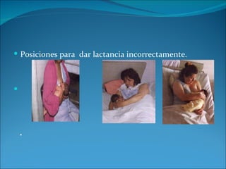  Posiciones para dar lactancia incorrectamente.








    •
 