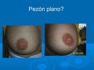 Pezón plano?
 