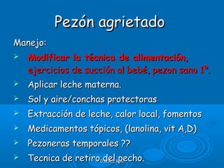 Manejo:Manejo:
 Modificar la técnica de alimentación,Modificar la técnica de alimentación,
ejercicios de succión al bebé, pezon sano 1º.ejercicios de succión al bebé, pezon sano 1º.
 Aplicar leche materna.Aplicar leche materna.
 Sol y aire/conchas protectorasSol y aire/conchas protectoras
 Extracción de leche, calor local, fomentosExtracción de leche, calor local, fomentos
 Medicamentos tópicos, (lanolina, vit A,D)Medicamentos tópicos, (lanolina, vit A,D)
 Pezoneras temporales ??Pezoneras temporales ??
 Tecnica de retiro del pecho.Tecnica de retiro del pecho.C.A.A.L.MA.C.A.A.L.MA.
Pezón agrietadoPezón agrietado
 