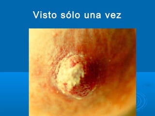 Visto sólo una vez
 