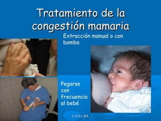 C.A.A.L.MA.C.A.A.L.MA.
Tratamiento de laTratamiento de la
congestión mamariacongestión mamaria
Extracción manual o con
bomba
Pegarse
con
frecuencia
al bebé
 