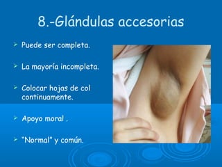 8.-Glándulas accesorias
 Puede ser completa.
 La mayoría incompleta.
 Colocar hojas de col
continuamente.
 Apoyo moral .
 “Normal” y común.
 