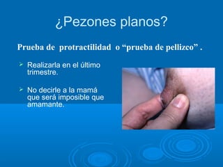 ¿Pezones planos?
 Realizarla en el último
trimestre.
 No decirle a la mamá
que será imposible que
amamante.
Prueba de protractilidad o “prueba de pellizco” .
 