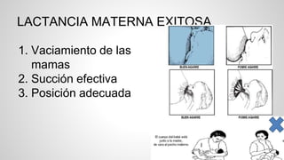 LACTANCIA MATERNA EXITOSA
1. Vaciamiento de las
mamas
2. Succión efectiva
3. Posición adecuada
 