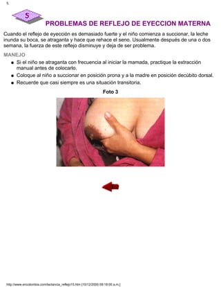 PROBLEMAS DE REFLEJO DE EYECCION MATERNA
Cuando el reflejo de eyección es demasiado fuerte y el niño comienza a succionar, la leche
inunda su boca, se atraganta y hace que rehace el seno. Usualmente después de una o dos
semana, la fuerza de este reflejo disminuye y deja de ser problema.
MANEJO
Si el niño se atraganta con frecuencia al iniciar la mamada, practique la extracción
manual antes de colocarlo.
q
Coloque al niño a succionar en posición prona y a la madre en posición decúbito dorsal.q
Recuerde que casi siempre es una situación transitoria.q
Foto 3
5.
http://www.encolombia.com/lactancia_reflejo15.htm [10/12/2000 09:18:00 a.m.]
 