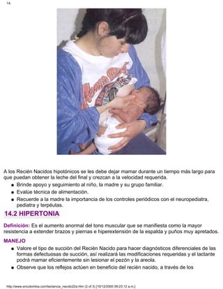A los Recién Nacidos hipotónicos se les debe dejar mamar durante un tiempo más largo para
que puedan obtener la leche del final y crezcan a la velocidad requerida.
Brinde apoyo y seguimiento al niño, la madre y su grupo familiar.q
Evalúe técnica de alimentación.q
Recuerde a la madre la importancia de los controles periódicos con el neuropediatra,
pediatra y terpéutas.
q
14.2 HIPERTONIA
Definición: Es el aumento anormal del tono muscular que se manifiesta como la mayor
resistencia a extender brazos y piernas e hiperextensión de la espalda y puños muy apretados.
MANEJO
Valore el tipo de succión del Recién Nacido para hacer diagnósticos diferenciales de las
formas defectuosas de succión, así realizará las modificaciones requeridas y el lactante
podrá mamar eficientemente sin lesionar el pezón y la areola.
q
Observe que los reflejos actúen en beneficio del recién nacido, a través de losq
14.
http://www.encolombia.com/lactancia_nacido22a.htm (2 of 3) [10/12/2000 09:23:12 a.m.]
 