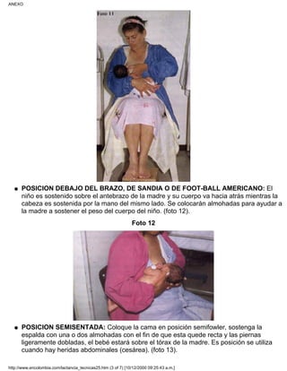 POSICION DEBAJO DEL BRAZO, DE SANDIA O DE FOOT-BALL AMERICANO: El
niño es sostenido sobre el antebrazo de la madre y su cuerpo va hacia atrás mientras la
cabeza es sostenida por la mano del mismo lado. Se colocarán almohadas para ayudar a
la madre a sostener el peso del cuerpo del niño. (foto 12).
q
Foto 12
POSICION SEMISENTADA: Coloque la cama en posición semifowler, sostenga la
espalda con una o dos almohadas con el fin de que esta quede recta y las piernas
ligeramente dobladas, el bebé estará sobre el tórax de la madre. Es posición se utiliza
cuando hay heridas abdominales (cesárea). (foto 13).
q
ANEXO
http://www.encolombia.com/lactancia_tecnicas25.htm (3 of 7) [10/12/2000 09:25:43 a.m.]
 